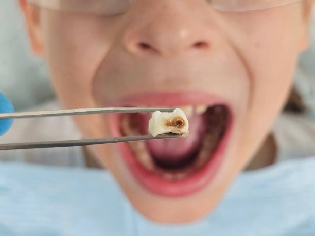 Best Emergency Dentist for Knocked-Out Tooth in Wendell, ID
